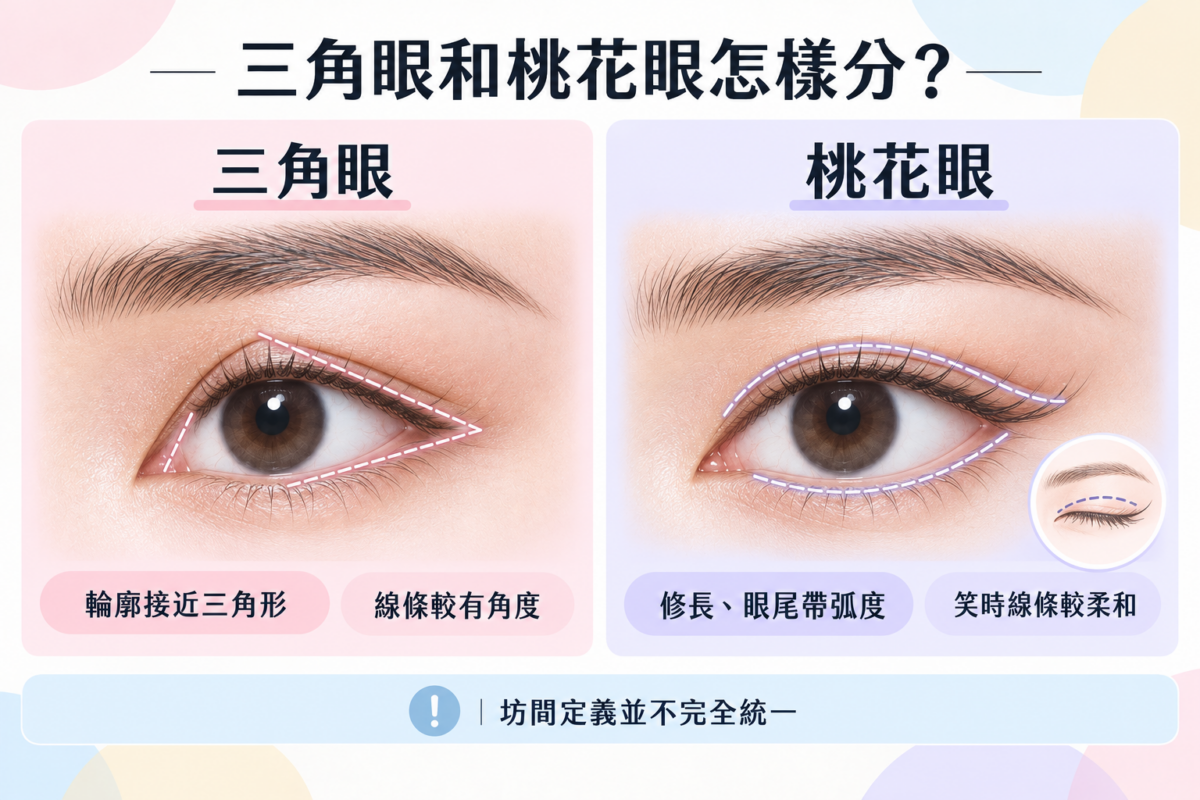 三角眼與桃花眼外觀特徵對照圖，包含三角眼的折角輪廓與桃花眼的修長弧度特徵。