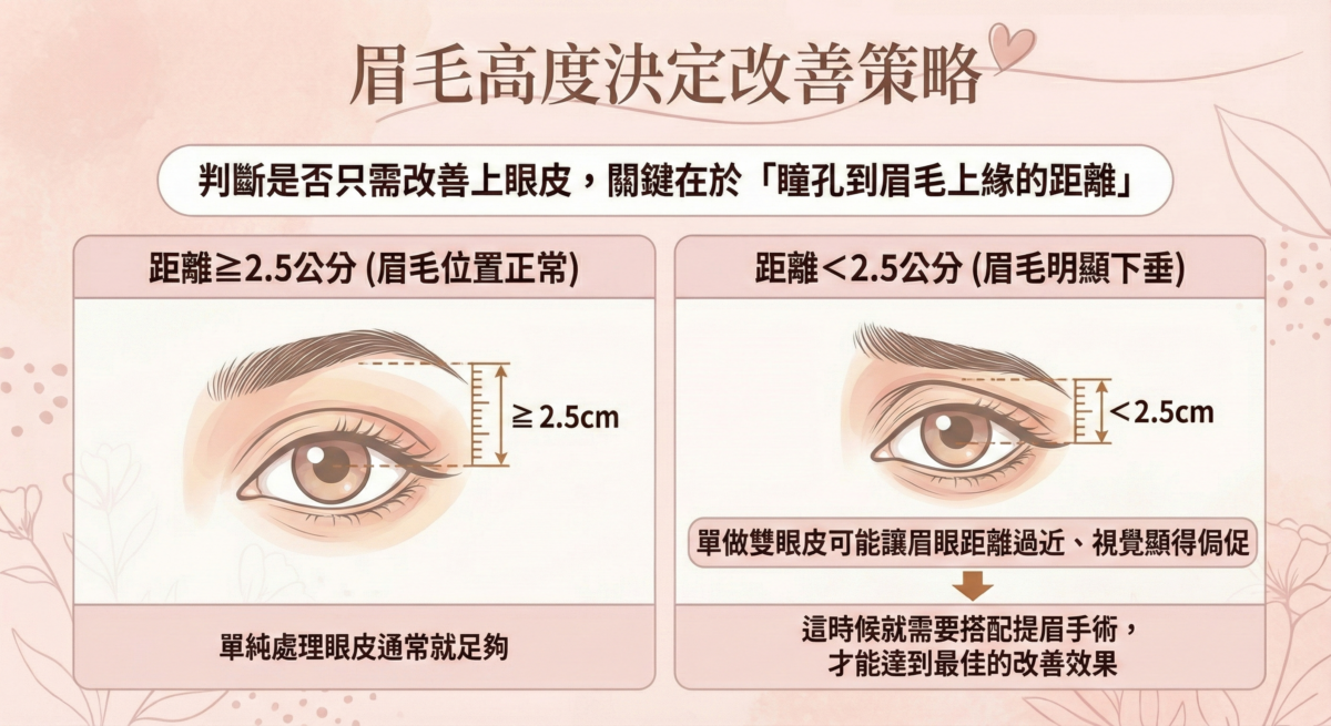 眉毛高度決定改善方式示意圖，說明了瞳孔到眉毛上緣≥2.5 公分可只處理眼皮；不足 2.5 公分且眉毛下垂者。