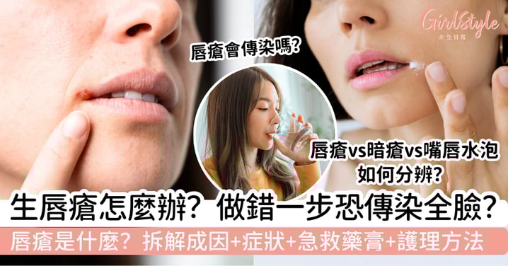 【唇瘡是什麼】生唇瘡怎麼辦?拆解成因+症狀+急救藥膏+護理方法!做錯一步恐傳染全臉?!