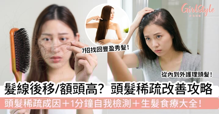 【頭髮稀疏改善】髮線後移、額頭高怎麼辦?7招救回濃密髮|成因+自我檢測+食療大全