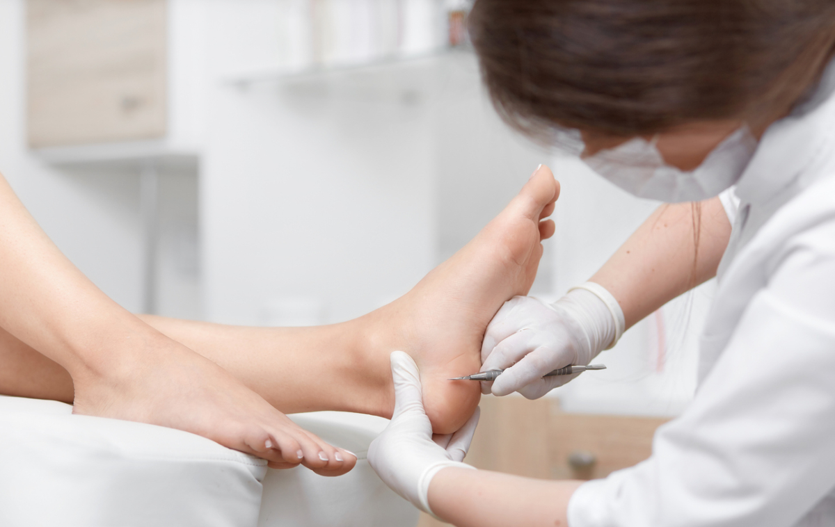 糖尿病、靜脈曲張或末梢神經感受不佳者使用雞眼貼布需特別小心，因其酸性成分可能導致皮膚受傷、感染或癒合困難，使用前應諮詢醫生。