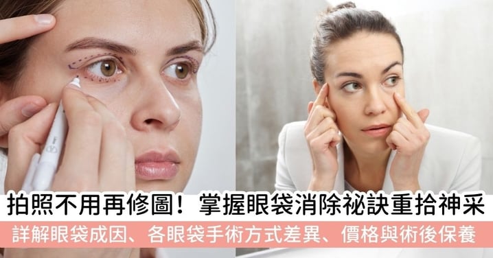 【眼袋消除】眼袋消除全攻略：詳解眼袋成因、各眼袋手術方式差異、價格與術後保養！擺脫疲態重拾年輕神采～
