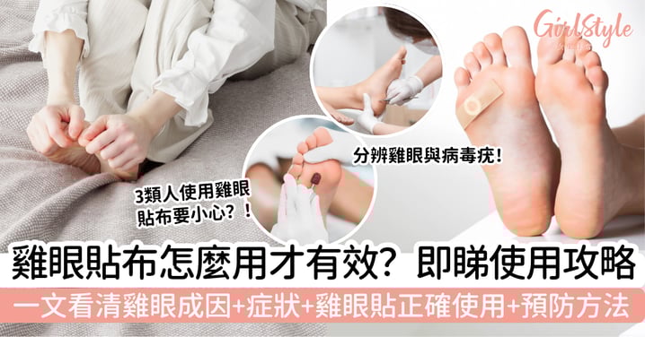 【雞眼貼布使用攻略】雞眼貼怎麼用？一文看清雞眼成因、症狀、正確使用與預防方法