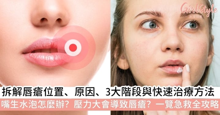 【嘴角生瘡】唇瘡急救全攻略｜嘴生水泡怎麼辦？拆解唇瘡位置、原因、3大階段與快速治療方法