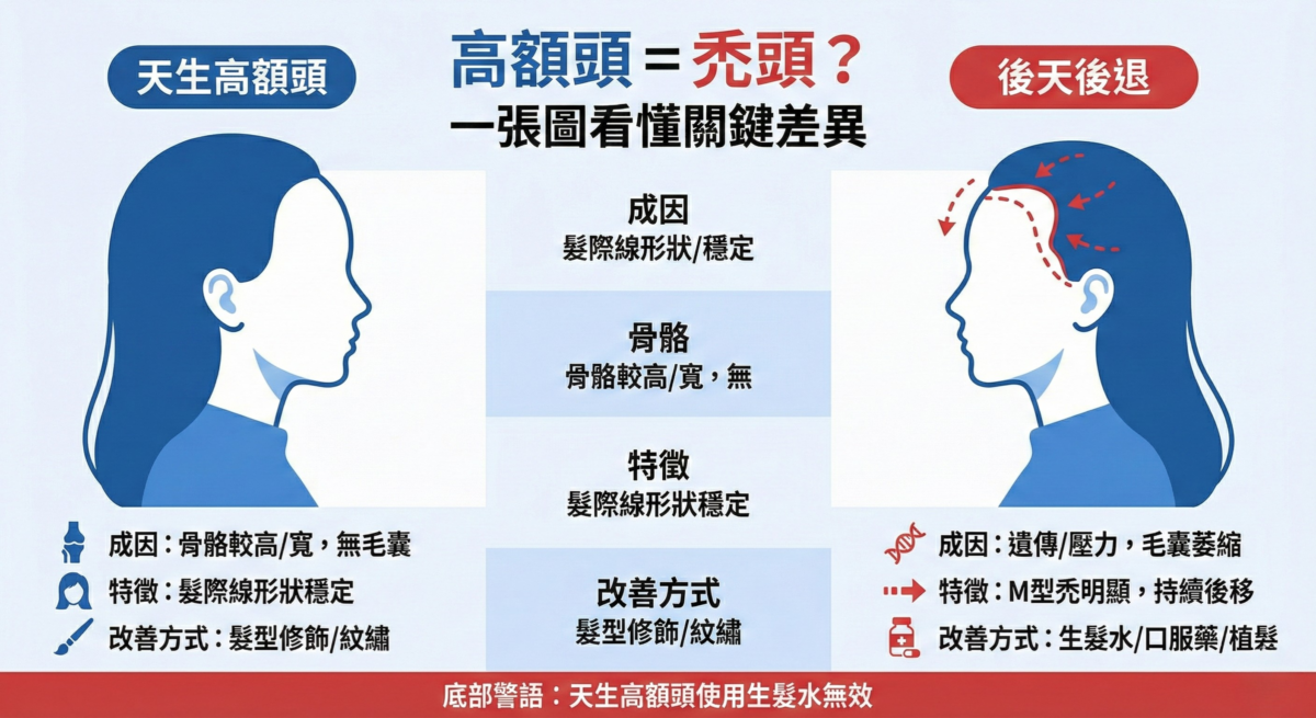 天生高額頭與後天髮際線後退差異比較表，分析成因、特徵與適合的改善方式，釐清禿頭迷思。