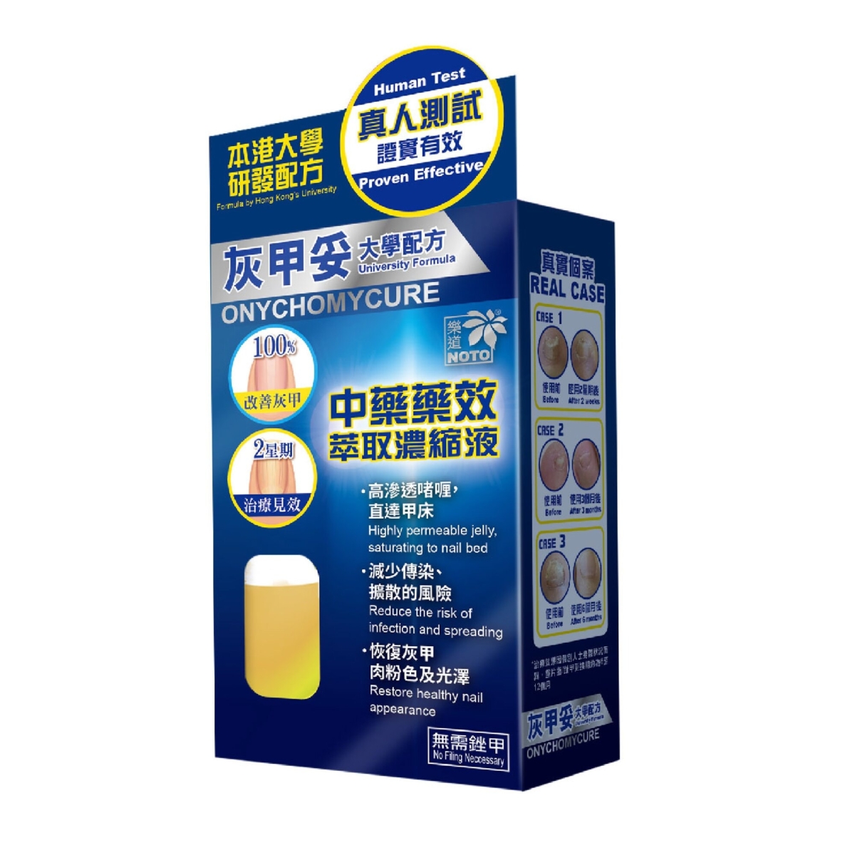 Noto 樂道灰甲妥高效啫喱能深層修護灰甲，改善變色、變厚和失去光澤的指（趾）甲。