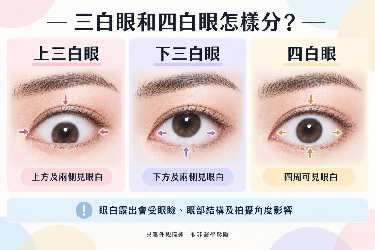 三白眼與四白眼區別圖解，對照上三白眼、下三白眼與四白眼的黑眼珠位置及眼白露出方向特徵。