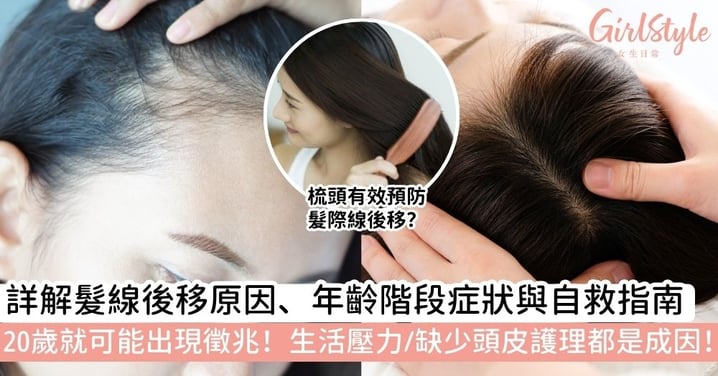 【髮線後移】髮際線後移有救嗎?詳解髮線後移原因、年齡階段與自救指南|20歲就可能出現徵兆!