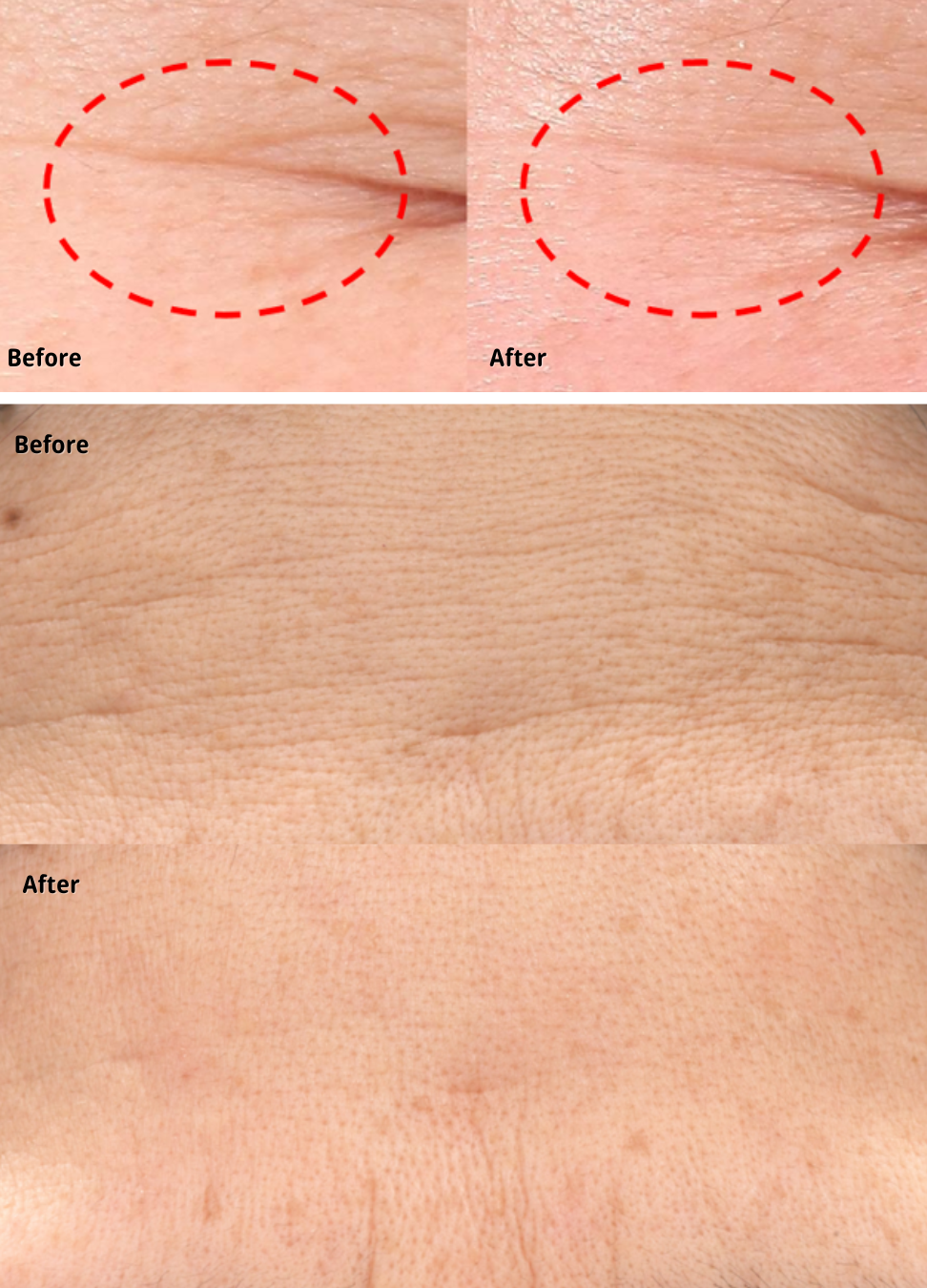 連一做表情都有的抬頭紋、魚尾紋都能KO！