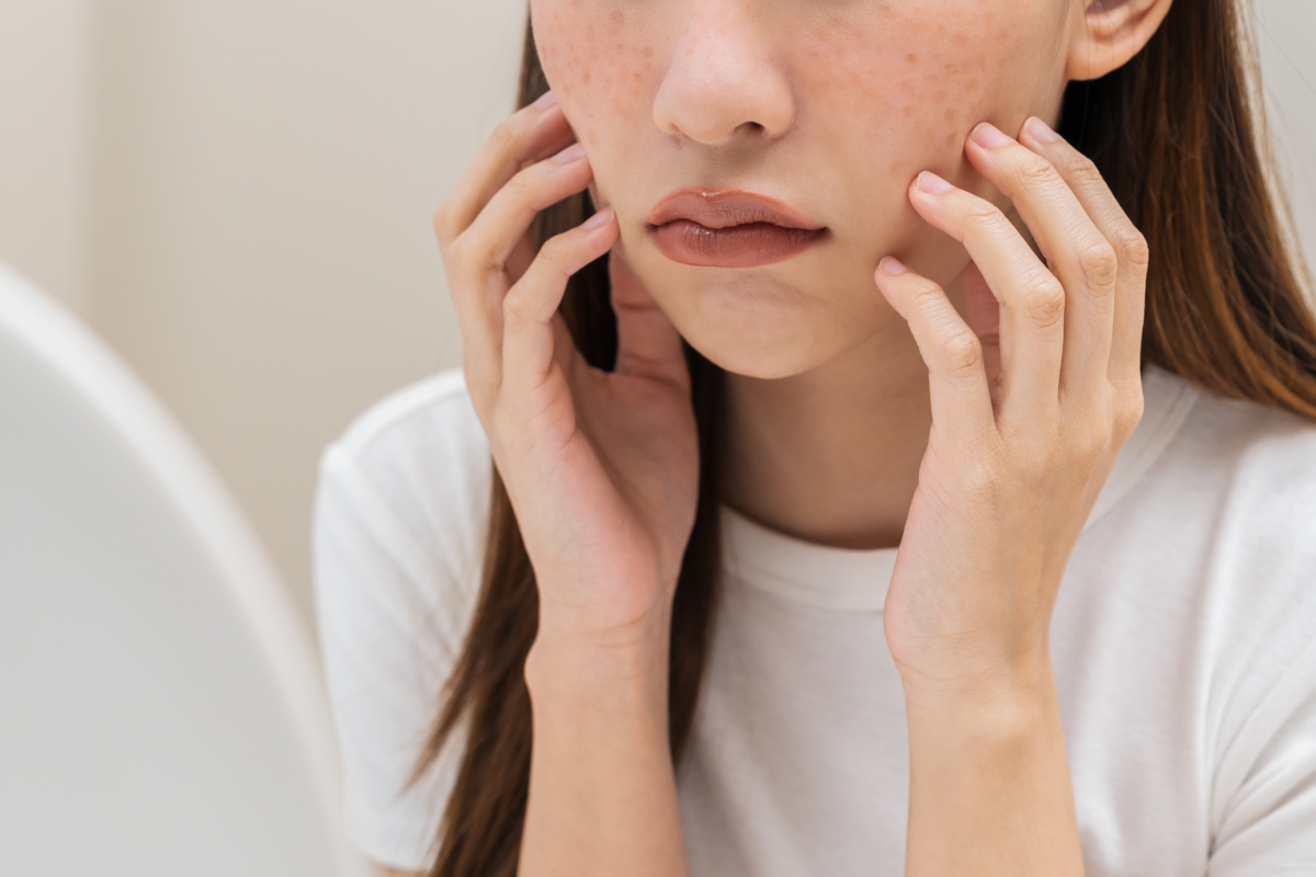 淡斑精華是改善暗沉蠟黃、打造透亮無瑕肌膚的關鍵。