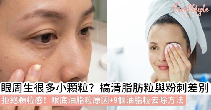 【眼底油脂粒】如何去除眼部油脂粒?脂肪粒、粉刺又該如何分辨?一文搞清眼底油脂粒原因+9招去除方法