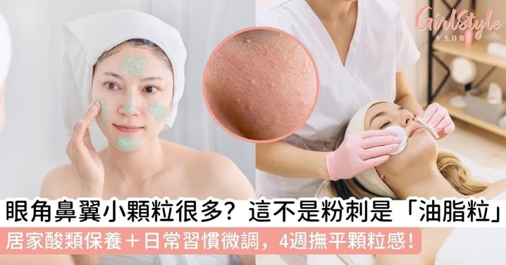 【油脂粒如何去除】眼角與鼻翼周圍經常生小顆粒？即了解油脂粒原因、日常保養與專業治療