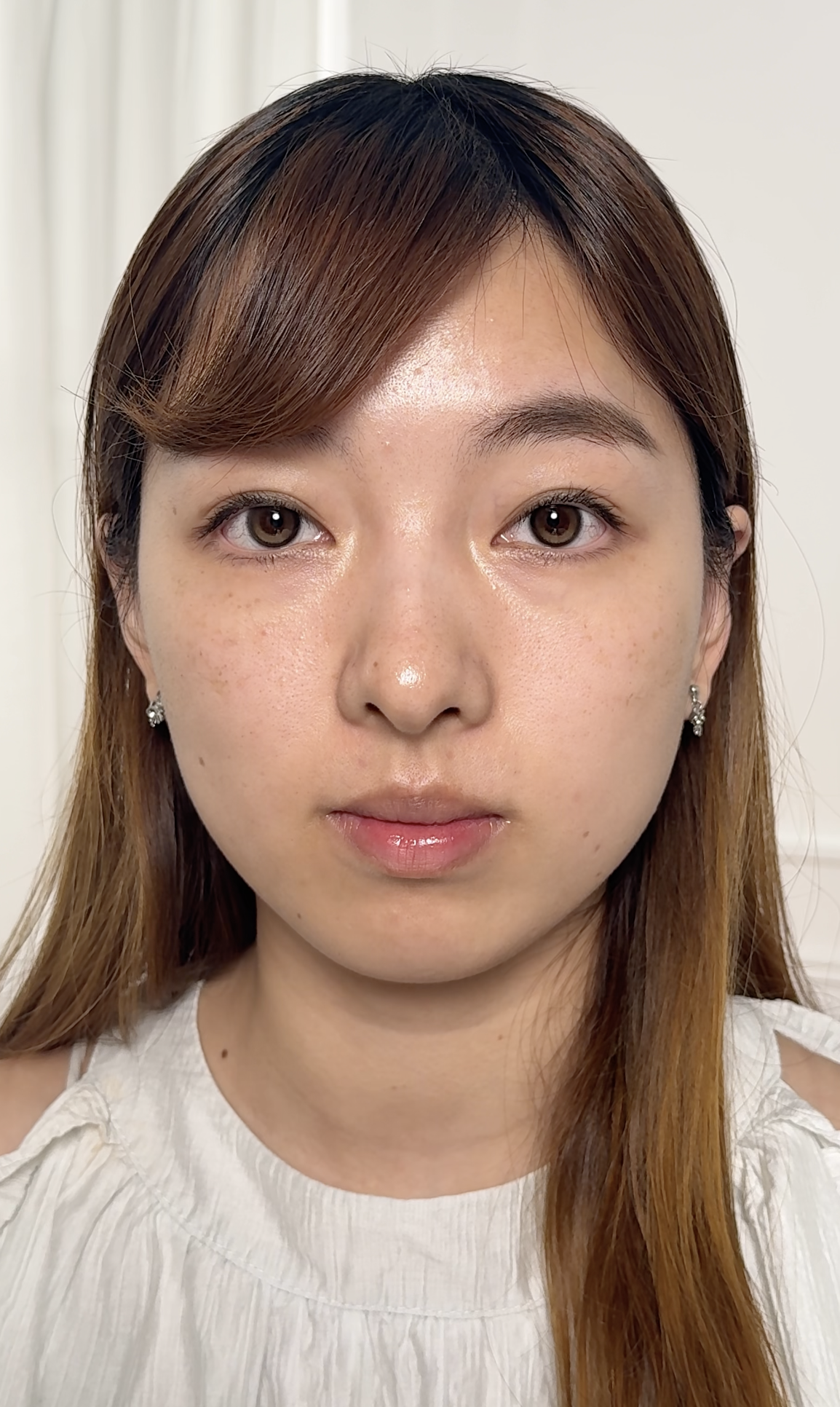 以前打斑，打完又生，生完又打，心很累！