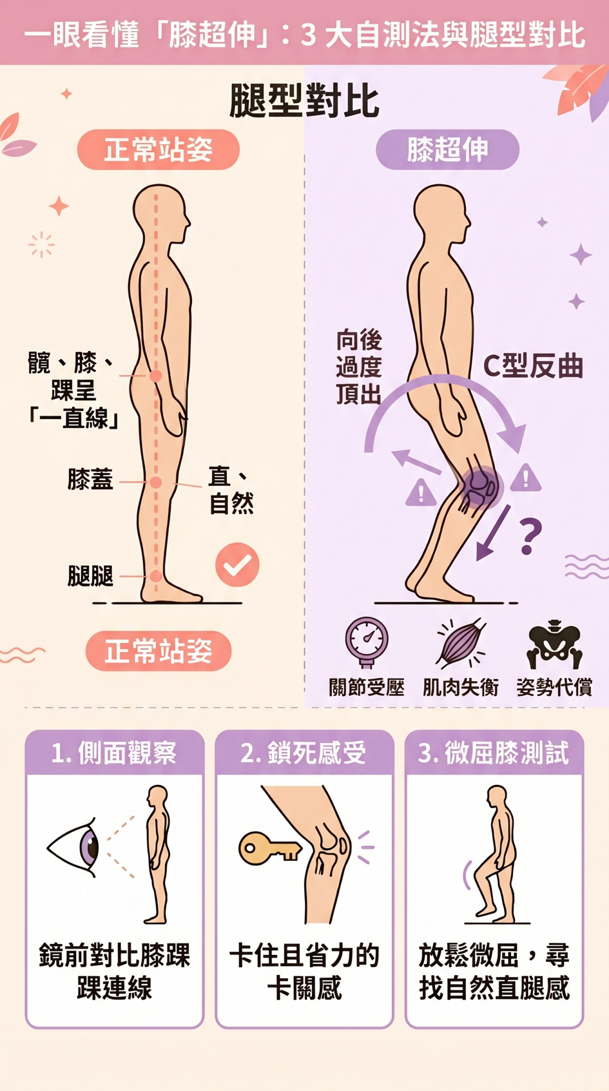 膝超伸三種自測方法圖解，包含側面站姿重力線觀察、關節鎖死感說明及微屈膝校正測試，幫助讀者判斷膝蓋是否過度後伸。