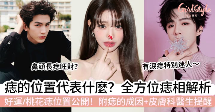 痣的位置代表什麼？全方位痣相解析：好運痣、桃花痣位置大公開＋皮膚科醫生提醒