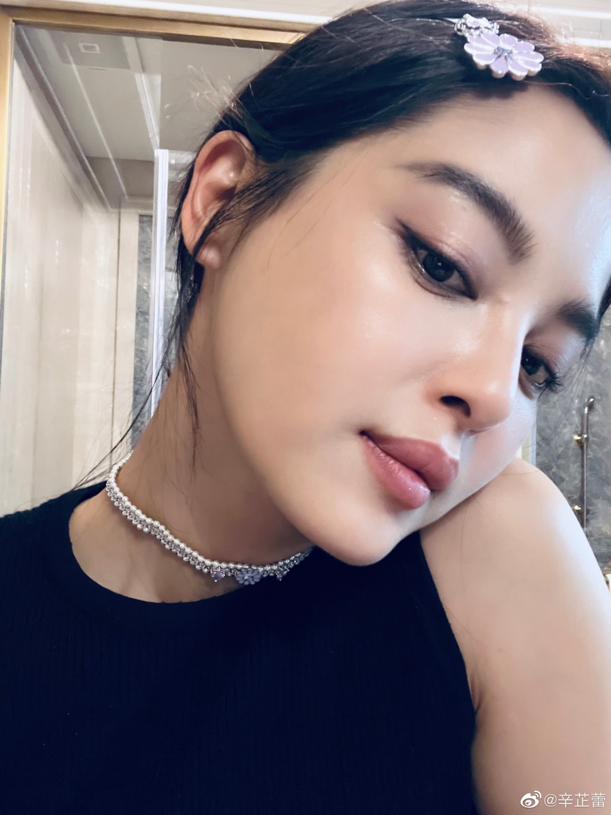 有些人因遺傳或唇部黑色素分布較多，天生唇色會偏深、偏紫紅或偏暗。