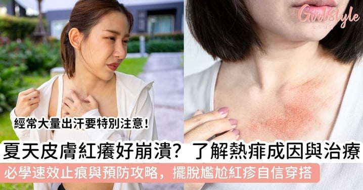 【熱痱】夏天背部、頸部生滿紅疹？一文了解熱痱原因＋症狀＋速效治療＋預防法，告別皮膚紅痕癢！