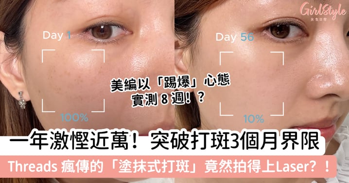 【踢爆官方數據？】突破醫美「3個月反彈」宿命！護膚品淡斑比得上打斑？小編從質疑到心服，只是 8 星期！