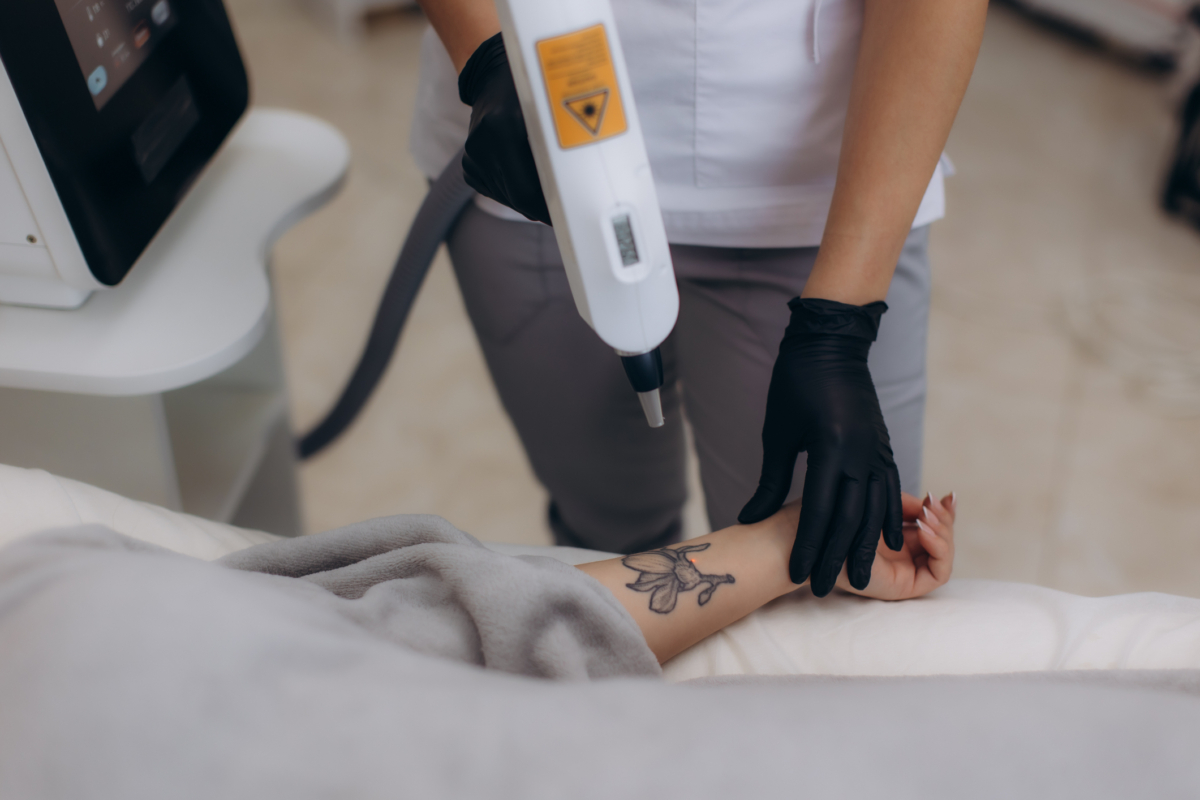 洗紋身前可先確認自己是想完全洗掉還是只想淡化，同時評估紋身顏色、是否易留疤、近期有沒有曝曬，以及自己能否接受這是一個需要時間的過程。