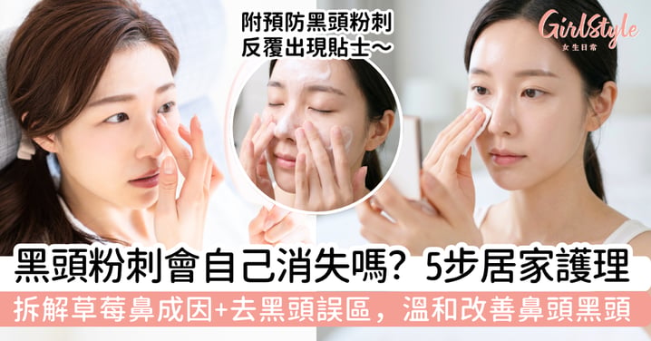 黑頭粉刺會自己消失嗎？拆解成因＋5 步居家護理，避開 3 大常見誤區