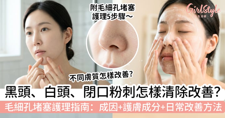 【毛細孔堵塞護理指南】黑頭、白頭、閉口粉刺怎樣清?成因、護膚成分與日常改善方法