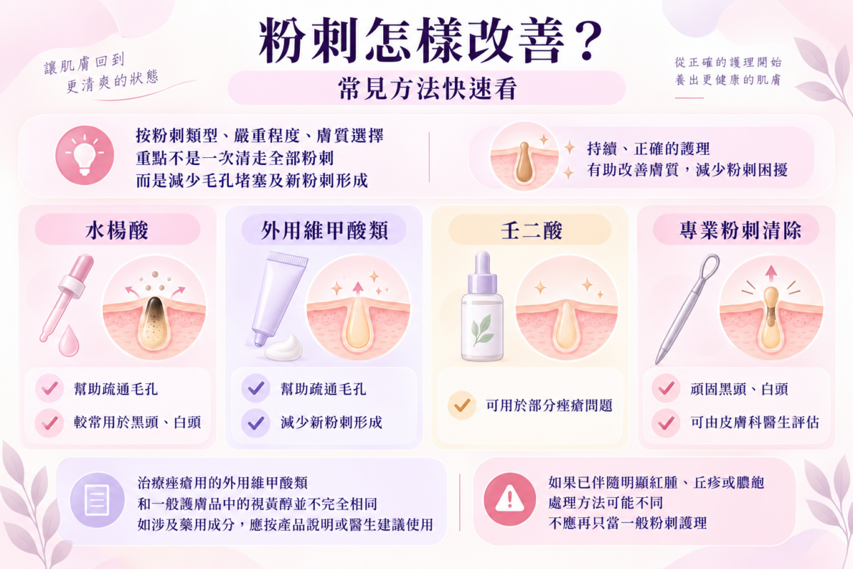 預防粉刺反覆的5個日常重點：圖解溫和清潔、選用 non-comedogenic 產品、避免過度刺激、適度保濕與不擠壓的保養指南。