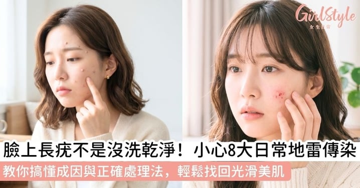 【臉上長疣原因】臉上長疣怎麼辦？搞懂臉上長疣原因與辨識重點！專業臉上長疣處理方法全解析