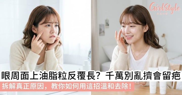 【面上油脂粒】反覆長出好困擾？千萬別亂擠！拆解真正油脂粒原因，專家教你油脂粒如何去除