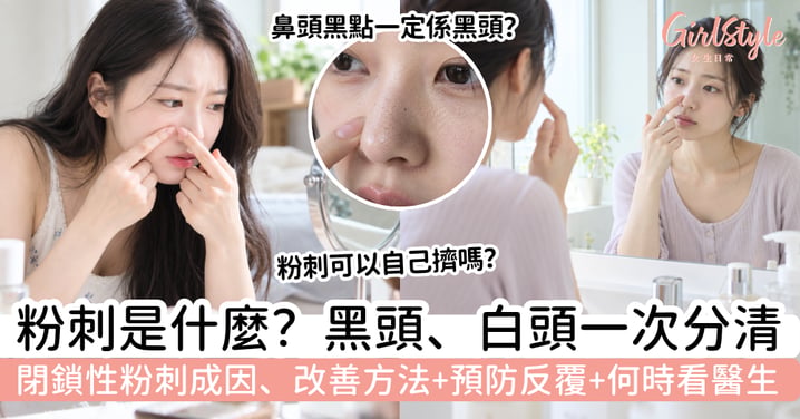 【粉刺是什麼？】黑頭、白頭、閉鎖性粉刺分別｜成因＋改善及預防方法