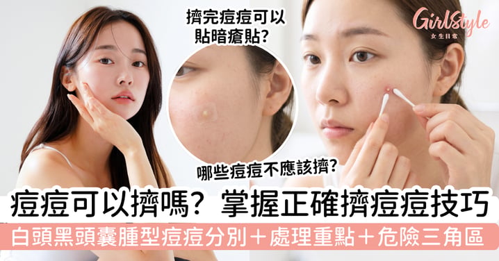 【擠痘痘2026】痘痘可以擠嗎？白頭、黑頭、囊腫型痘痘處理重點＋危險三角區＋暗瘡貼護理