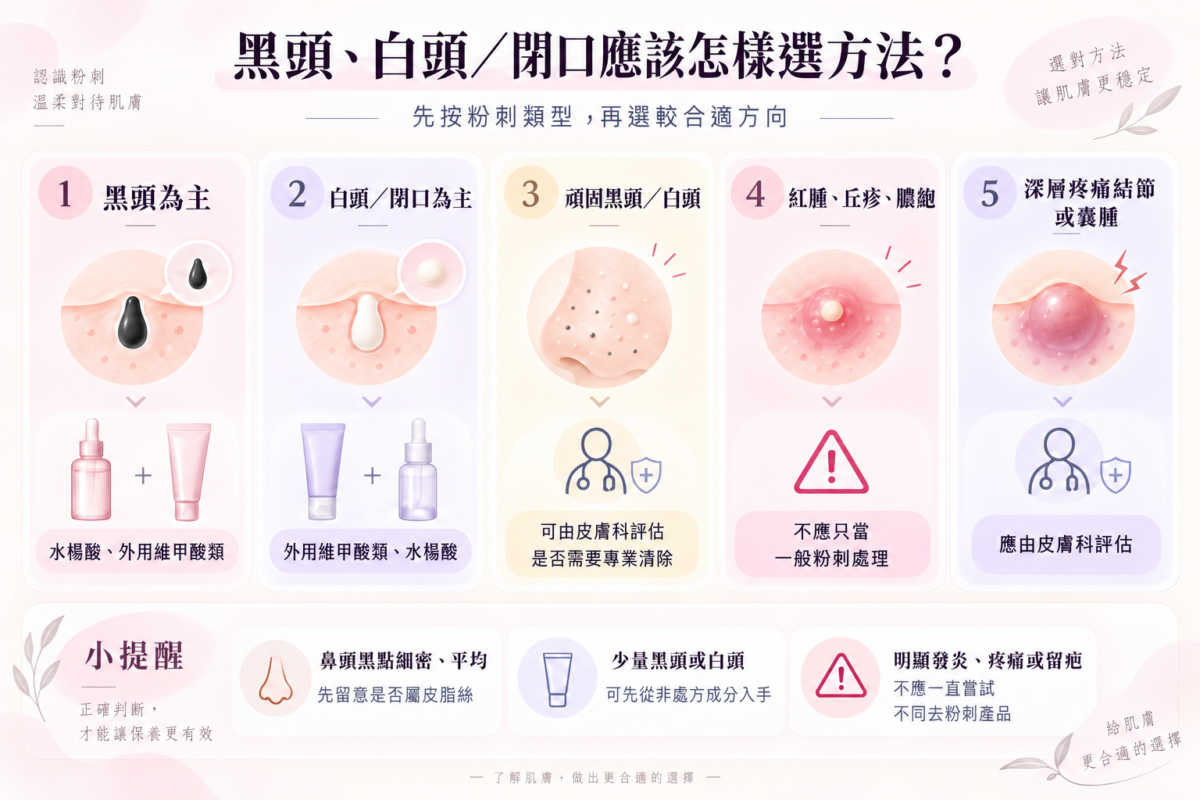 粉刺痘痘處理方法對照圖表：比較黑頭、白頭閉口、頑固粉刺、紅腫丘疹與囊腫的護膚成分（水楊酸、Retinoid）與皮膚科就醫建議。