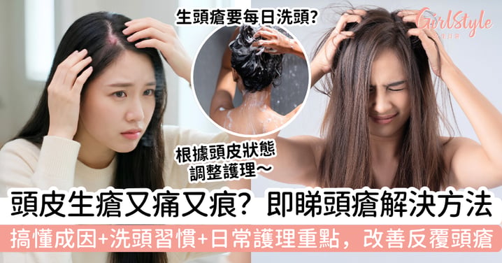 【頭瘡解決方法】頭皮生瘡又痛又痕？成因、洗頭習慣與日常護理重點，改善反覆頭瘡