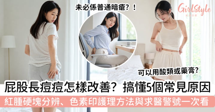 【屁股長痘痘】屁股痘痘怎樣改善?5個常見原因、紅腫硬塊分辨、色素印護理與求醫警號
