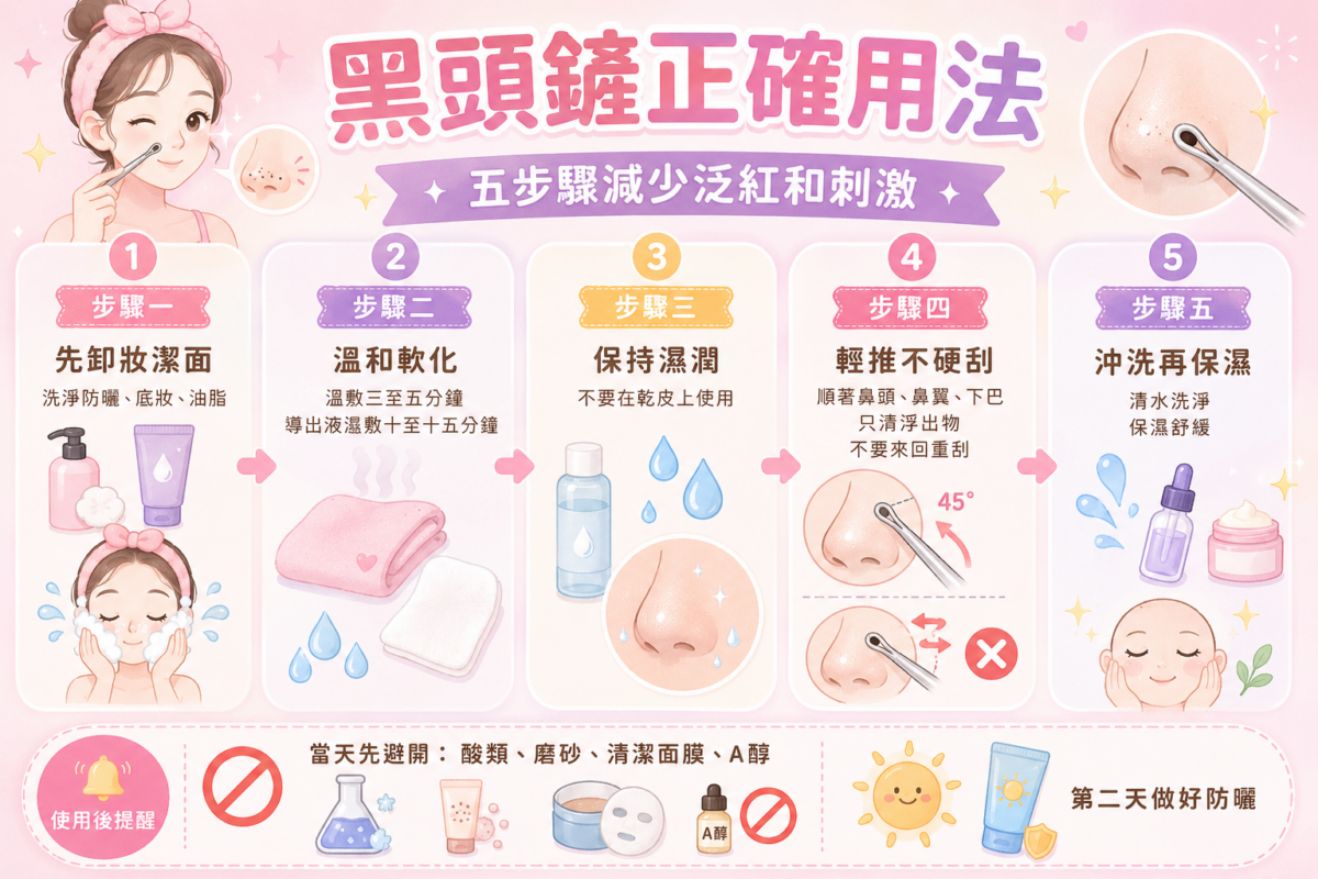 黑頭鏟正確使用方法 5 步驟流程圖:包含卸妝潔面、熱敷軟化、保持濕潤、45度角輕推與保濕舒緩的溫和護膚教學,教你如何減少皮膚泛紅與刺激。