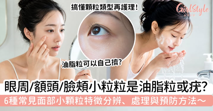 【油脂粒疣】眼周、額頭或臉頰小粒粒是油脂粒還是疣?6種面部小顆粒分辨、處理與預防方法
