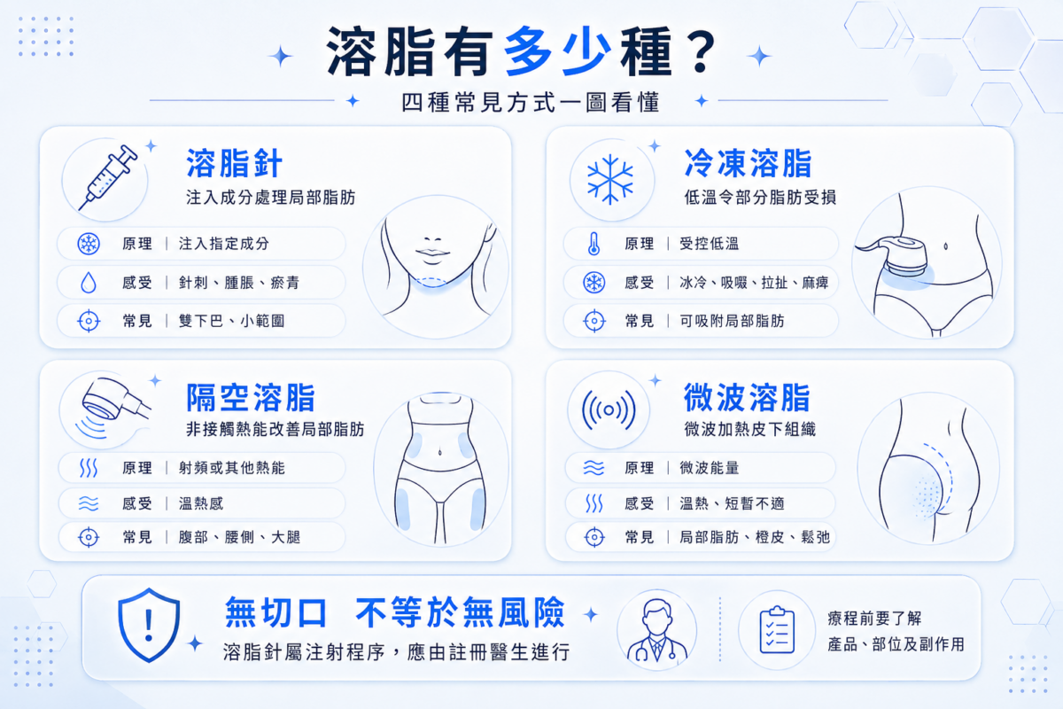 四大溶脂療程比較圖：溶脂針、冷凍溶脂、隔空溶脂與 Onda 溶脂之原理、體感及適用部位懶人包。 