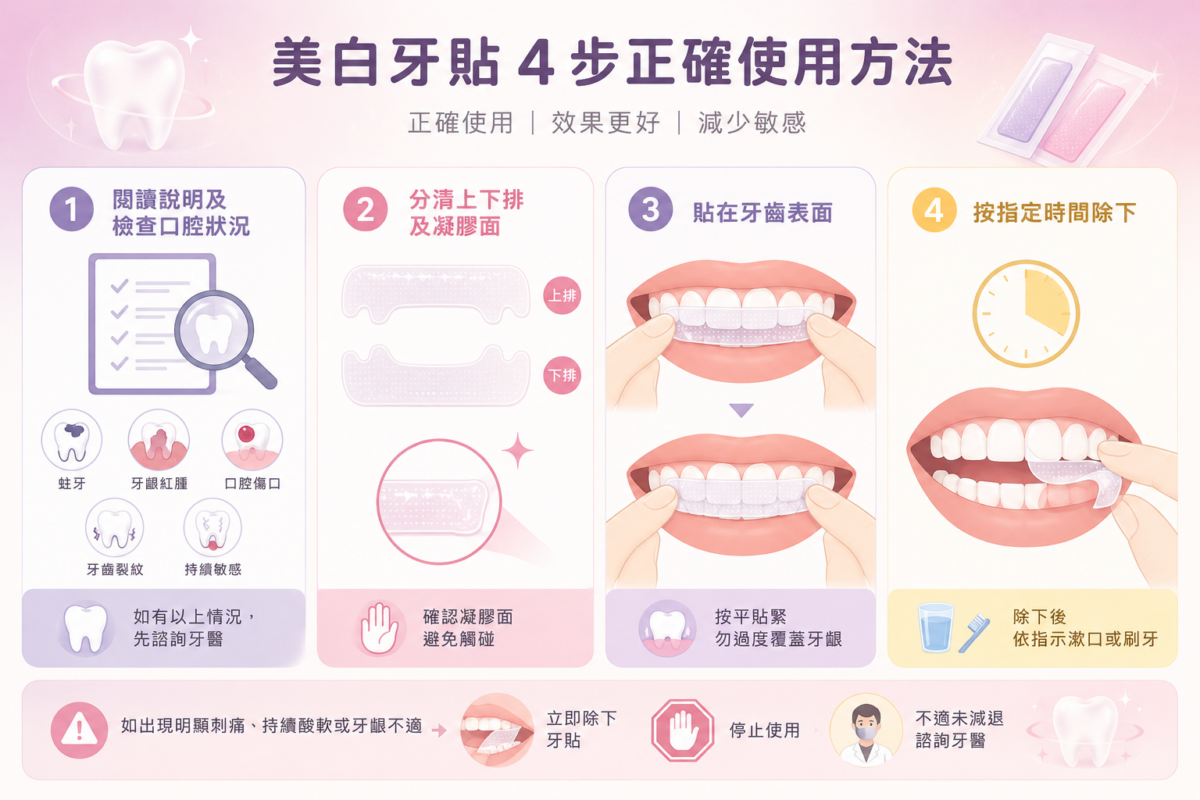 4步正確使用美白牙貼流程圖:包含檢查口腔狀況、區分凝膠面、按壓貼合天然牙面避開牙齦,以及定時除下與清潔殘留凝膠的正確步驟。