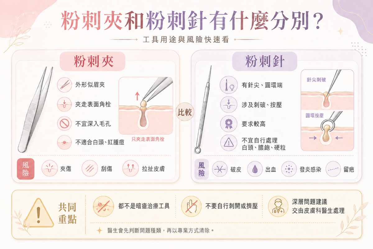 粉刺夾與粉刺針的功能、適用情境及操作風險比較圖。