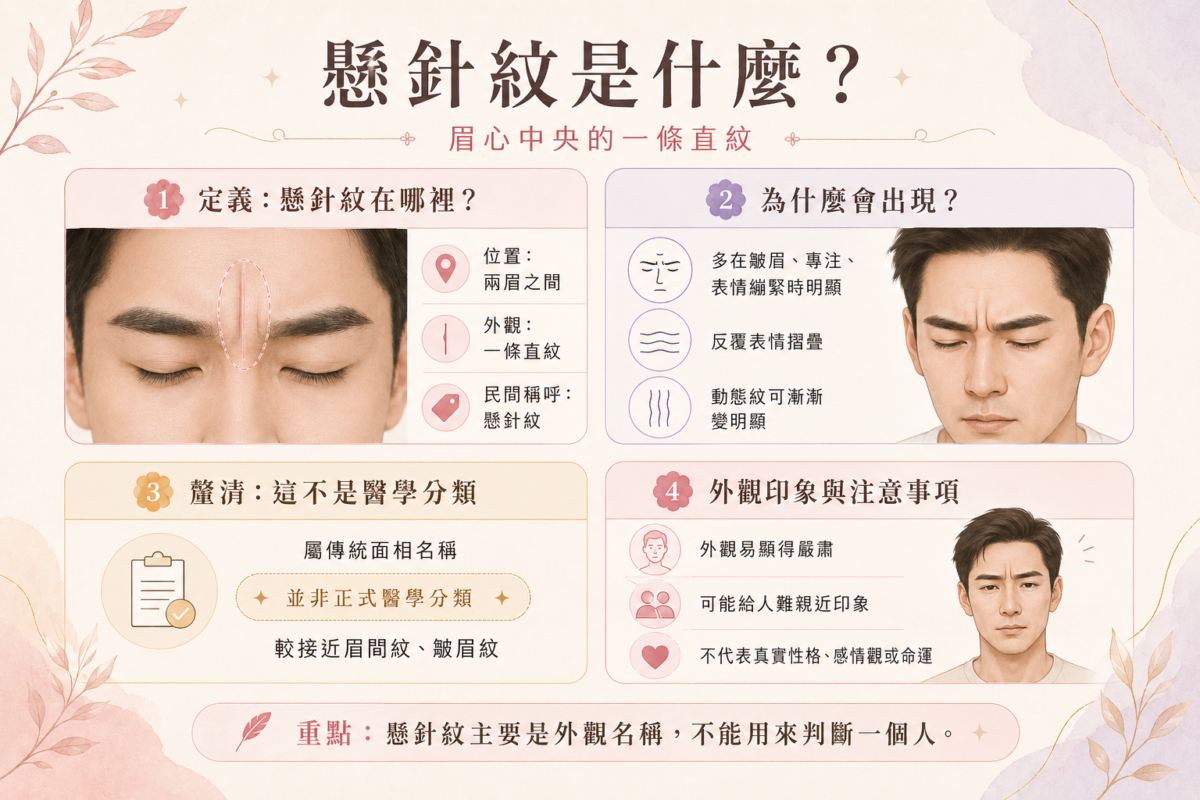 懸針紋3大關鍵解析圖:圖解眉心懸針紋的位置特徵、皮膚形成原因(動態紋轉靜態紋),以及外觀印象與面相迷思說明。