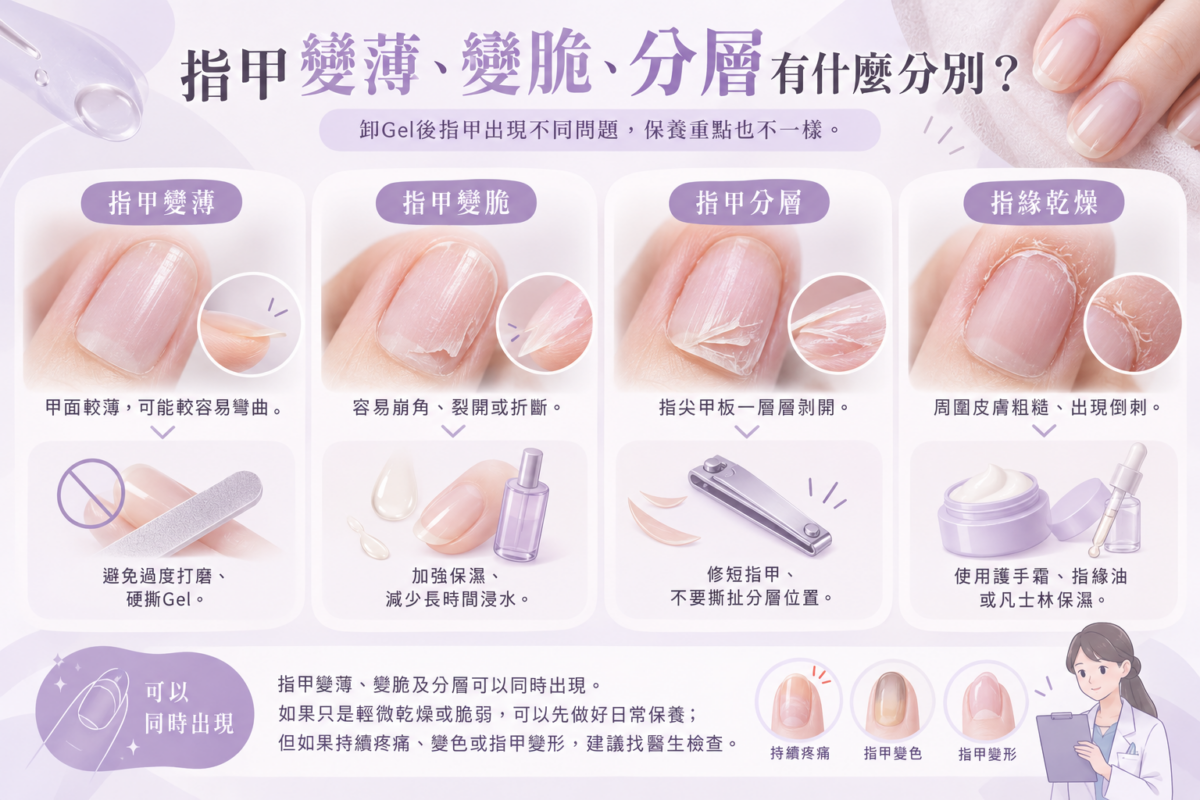 指甲問題比較圖解，展示卸Gel後指甲變薄、變脆、分層及指緣乾燥的不同表現，並整理各種情況的保養重點。