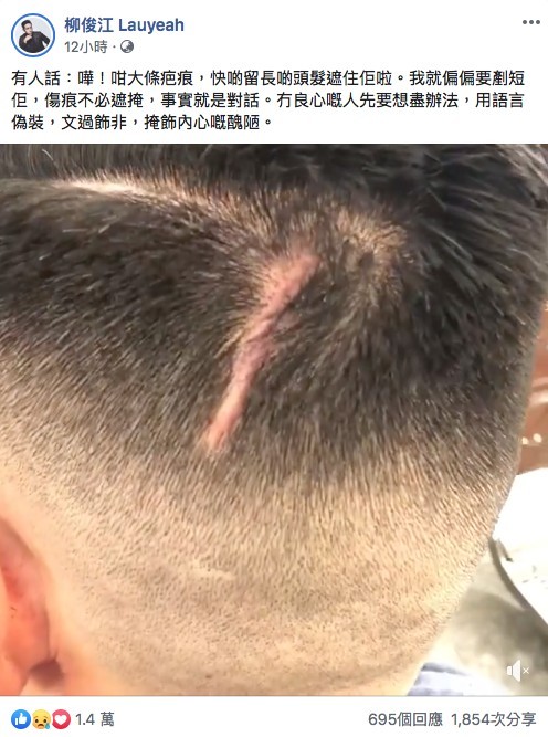 柳俊江拒留長髮反而剷短頭髮