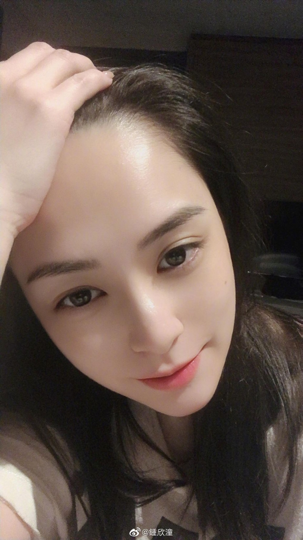 阿嬌於廈門下榻酒店房間發生意外,頭部受傷。