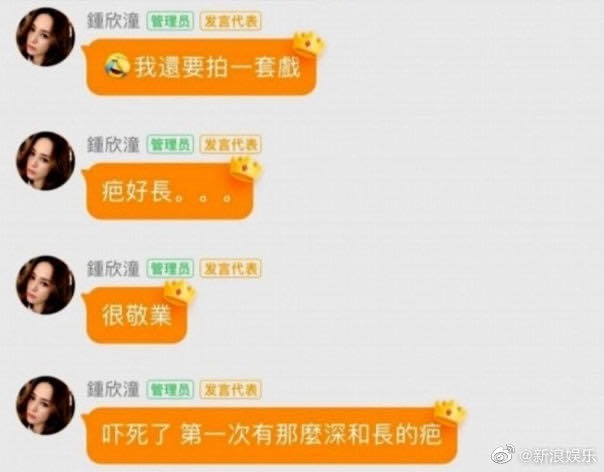 阿嬌指自己受傷都嚇親：「第一次有那麼深和長的疤」又指：「但沒哭」