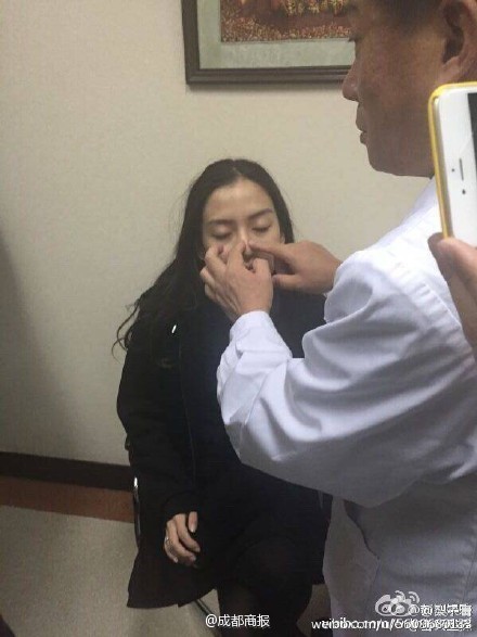 整容傳聞甚囂塵上,Baby甚至親自到醫療機構進行面部鑒定,更公開鑒定結果力證自己無整過容。