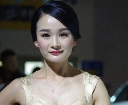微博上流傳卓亨瑜6年前嘅舊照,稱係佢「未動刀」嘅樣子