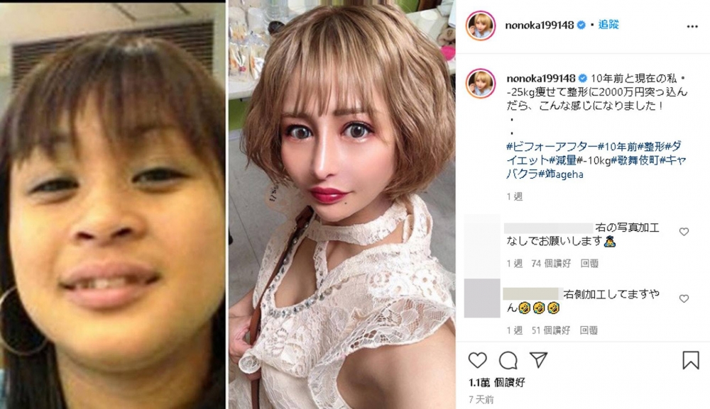 櫻井野之花大方上載整形前後對比圖到IG。