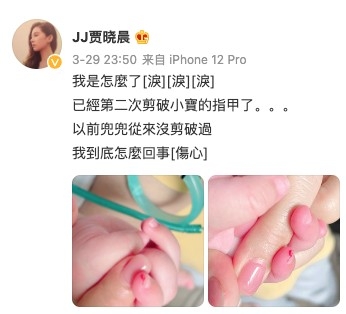 賈曉晨幫小飯團剪指甲時唔小心剪傷女兒