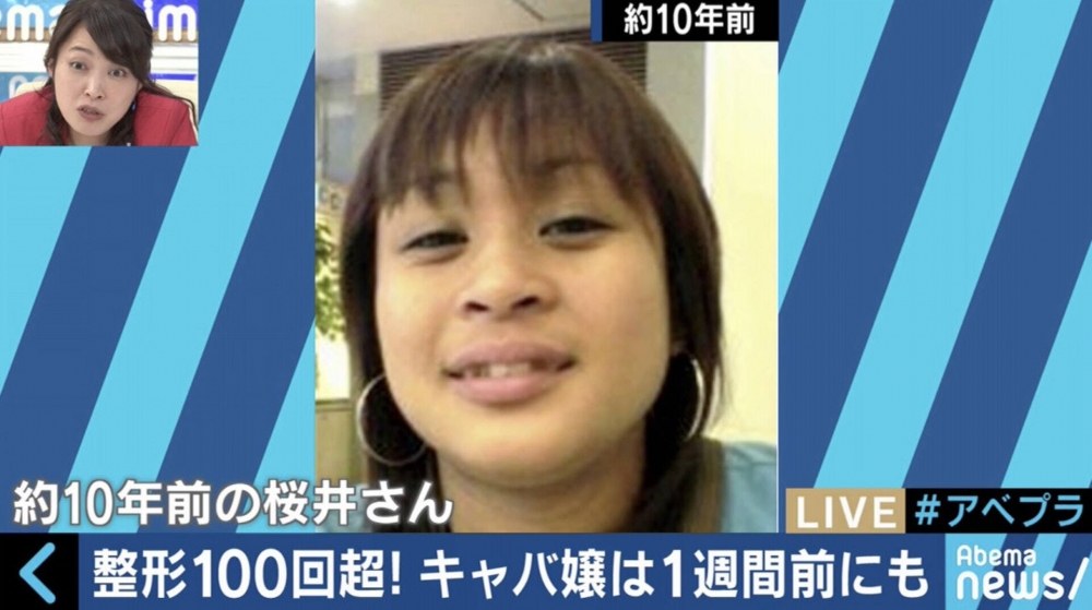 櫻井野之花曾上載自己未整形相片。