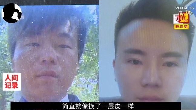 丈夫羅志強整容前後對比圖