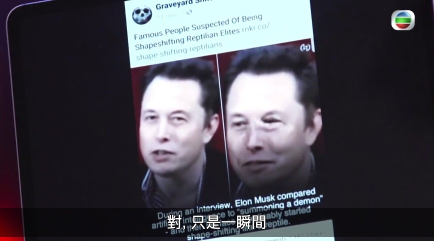 Tesla總裁 Elon Musk左眼曾經突然腫起!
